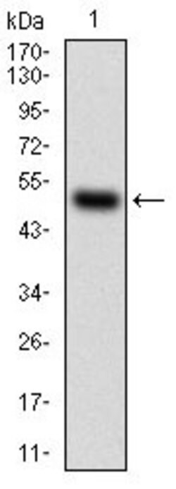 Invitrogen HDAC10 Monoclonal Antibody (3B6B8) 100 &mu;g; Unconjugated:Antibodies,