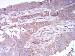 HDAC4 Monoclonal Antibody (5E4A5):Antibodies, Monoclonal