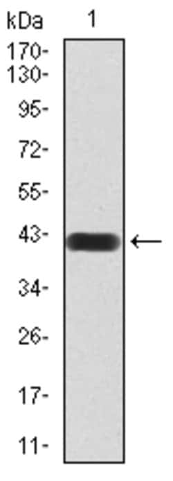 HDAC4 Monoclonal Antibody (5E4A5):Antibodies, Monoclonal