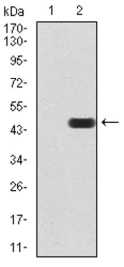 HDAC4 Monoclonal Antibody (5E4A5):Antibodies, Monoclonal