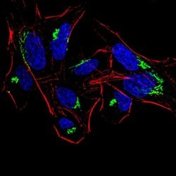Invitrogen HDAC4 Monoclonal Antibody (7E2E6) 100 &mu;g; Unconjugated:Antibodies,