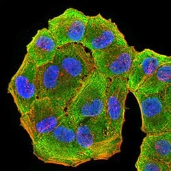 HLA-DRA Monoclonal Antibody (1C11A5):Antibodies, Monoclonal