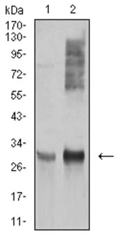 HLA-DRA Monoclonal Antibody (1C11A5):Antibodies, Monoclonal