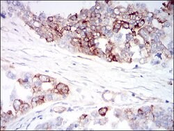Invitrogen IGFBP7 Monoclonal Antibody (1D9E7) 100 &mu;g; Unconjugated:Antibodies,