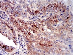 Invitrogen IGFBP7 Monoclonal Antibody (1D9E7) 100 &mu;g; Unconjugated:Antibodies,