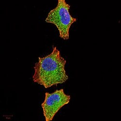 Invitrogen IRAK-M Monoclonal Antibody (6G9G2) 100 &mu;g; Unconjugated:Antibodies,