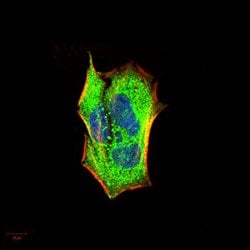 Invitrogen IRAK-M Monoclonal Antibody (6G9G2) 100 &mu;g; Unconjugated:Antibodies,