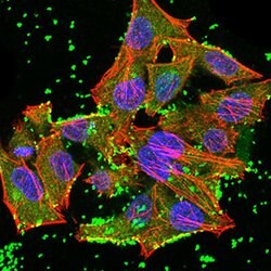 JARID2 Monoclonal Antibody (7H1B3):Antibodies, Monoclonal