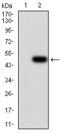 JARID2 Monoclonal Antibody (7H1B3):Antibodies, Monoclonal