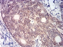 Invitrogen MYST2 Monoclonal Antibody (1D9H9) 100 &mu;g; Unconjugated:Antibodies,