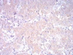 Invitrogen LDLR Monoclonal Antibody (1B10H10) 100 &mu;g | Buy Online | Invitrogen&trade; | Fisher Scientific