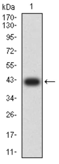 Invitrogen LRP8 Monoclonal Antibody (7G12E2) 100 &mu;g; Unconjugated:Antibodies,