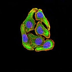 Invitrogen MEK3 Monoclonal Antibody (2E12D11) 100 &mu;g; Unconjugated:Antibodies,
