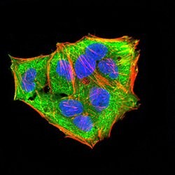Invitrogen MEK3 Monoclonal Antibody (2E12D11) 100 &mu;g; Unconjugated:Antibodies,