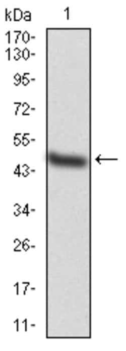 Invitrogen TAK1 Monoclonal Antibody (3E8H4) 100 &mu;g; Unconjugated:Antibodies,