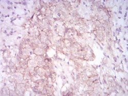 MMP14 Monoclonal Antibody (6A11D1):Antibodies, Monoclonal