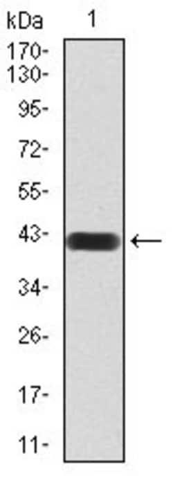 MMP14 Monoclonal Antibody (6A11D1):Antibodies, Monoclonal