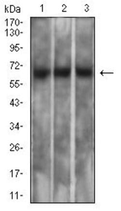 Invitrogen Mesothelin Monoclonal Antibody (7E6A6) 100 &mu;g; Unconjugated:Antibodies,