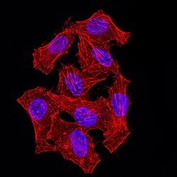 Invitrogen hnRNP M Monoclonal Antibody (5G6C11) 100 &mu;g; Unconjugated:Antibodies,