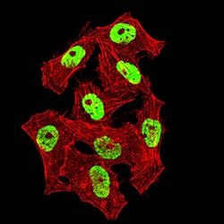 Invitrogen hnRNP M Monoclonal Antibody (5G6C11) 100 &mu;g; Unconjugated:Antibodies,