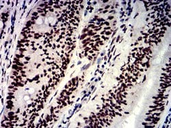 Invitrogen hnRNP M Monoclonal Antibody (5G6C11) 100 &mu;g; Unconjugated:Antibodies,