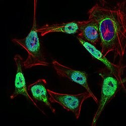 Invitrogen NBS1 Monoclonal Antibody (7E4C2) 100 &mu;g; Unconjugated:Antibodies,