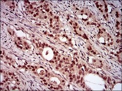 Invitrogen NBS1 Monoclonal Antibody (7E4C2) 100 &mu;g; Unconjugated:Antibodies,