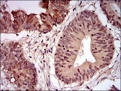 Invitrogen NBS1 Monoclonal Antibody (7E4C2) 100 &mu;g; Unconjugated:Antibodies,