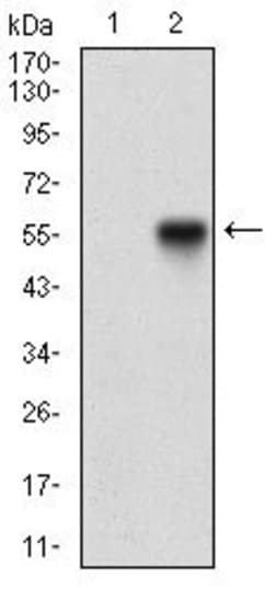 Invitrogen NBS1 Monoclonal Antibody (7E4A2) 100 &mu;g | Buy Online | Invitrogen&trade; | Fisher Scientific