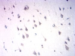 NeuroD1 Monoclonal Antibody (4G12B4):Antibodies, Monoclonal