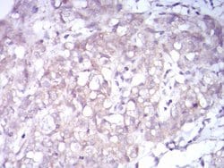 Invitrogen TrkB Monoclonal Antibody (10B6C4) 100 &mu;g; Unconjugated:Antibodies,