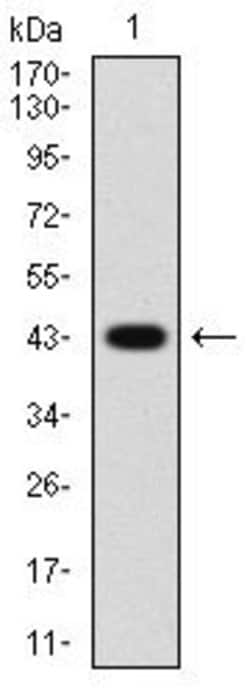 Invitrogen PDGFRA Monoclonal Antibody (8E12F2) 100 &mu;g | Buy Online | Invitrogen&trade; | Fisher Scientific
