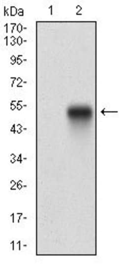Invitrogen PDGFRA Monoclonal Antibody (8E12F2) 100 &mu;g | Buy Online | Invitrogen&trade; | Fisher Scientific