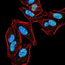 Invitrogen PLCG2 Monoclonal Antibody (3A8B6) 100 &mu;g; Unconjugated:Antibodies,