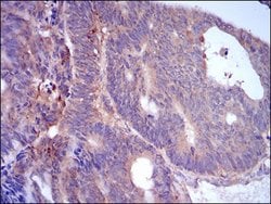 Invitrogen ADFP Monoclonal Antibody (2C5H8) 100 &mu;g; Unconjugated:Antibodies,
