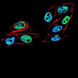 Invitrogen PMS2 Monoclonal Antibody (1E9D11) 100 &mu;g; Unconjugated:Antibodies,