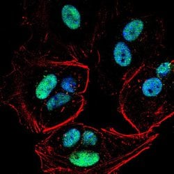 Invitrogen PMS2 Monoclonal Antibody (1E9D11) 100 &mu;g; Unconjugated:Antibodies,