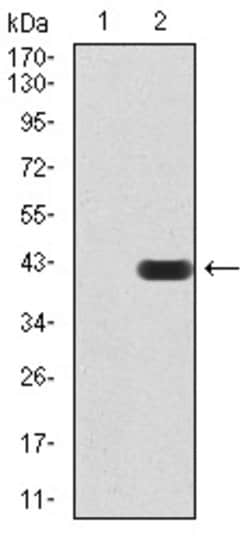 Invitrogen PMS2 Monoclonal Antibody (1E9D11) 100 &mu;g; Unconjugated:Antibodies,