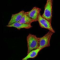 Invitrogen PSMC3 Monoclonal Antibody (1G10C9) 100 &mu;g; Unconjugated:Antibodies,