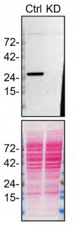 Invitrogen RAB27B Monoclonal Antibody (2G11C2) 100 &mu;g | Buy Online | Invitrogen&trade; | Fisher Scientific