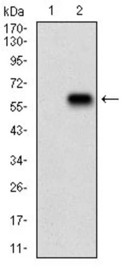 Invitrogen RAP1GAP Monoclonal Antibody (2G7B6) 100 &mu;g; Unconjugated:Antibodies,