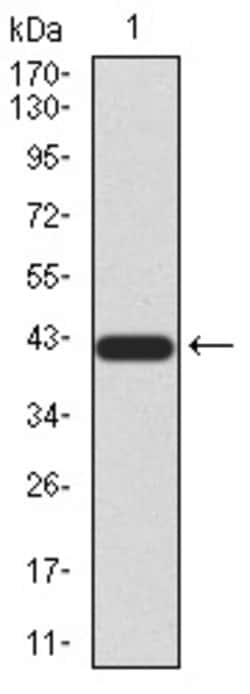 Invitrogen SIRT3 Monoclonal Antibody (6B2A1) 100 &mu;g; Unconjugated:Antibodies,