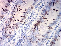 Invitrogen TOP2A Monoclonal Antibody (6D4B2) 100 &mu;g; Unconjugated:Antibodies,