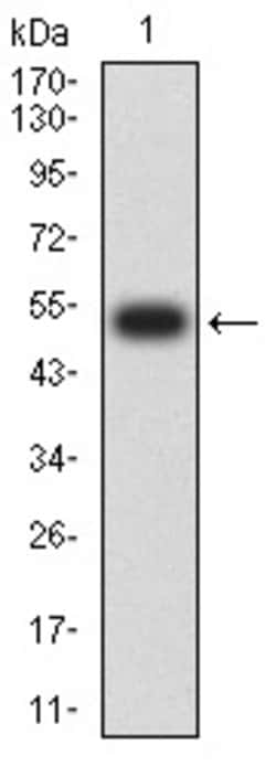 Invitrogen TOP2A Monoclonal Antibody (6D4B2) 100 &mu;g; Unconjugated:Antibodies,