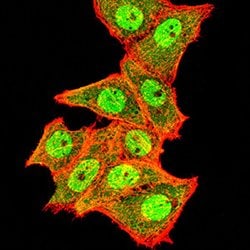 Invitrogen&trade;&nbsp;TOP2A Monoclonal Antibody (6C12G12)