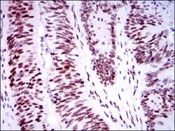 Invitrogen 53BP1 Monoclonal Antibody (6B3E10) 100 &mu;g; Unconjugated:Antibodies,