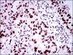 Invitrogen 53BP1 Monoclonal Antibody (6B3E10) 100 &mu;g; Unconjugated:Antibodies,