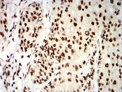 Invitrogen UHRF1 Monoclonal Antibody (1A1B1) 100 &mu;g; Unconjugated:Antibodies,