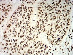 Invitrogen UHRF1 Monoclonal Antibody (1A1B1) 100 &mu;g; Unconjugated:Antibodies,