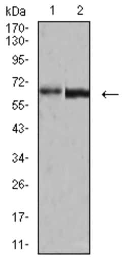 Invitrogen Human Parvovirus VP2 Monoclonal Antibody (4E5A4) 100 &mu;g;